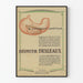 Plakat vintage Le pansement gastrique Bismuth Desleaux