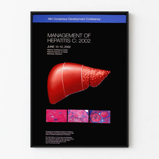 management-of-hepatitis-c